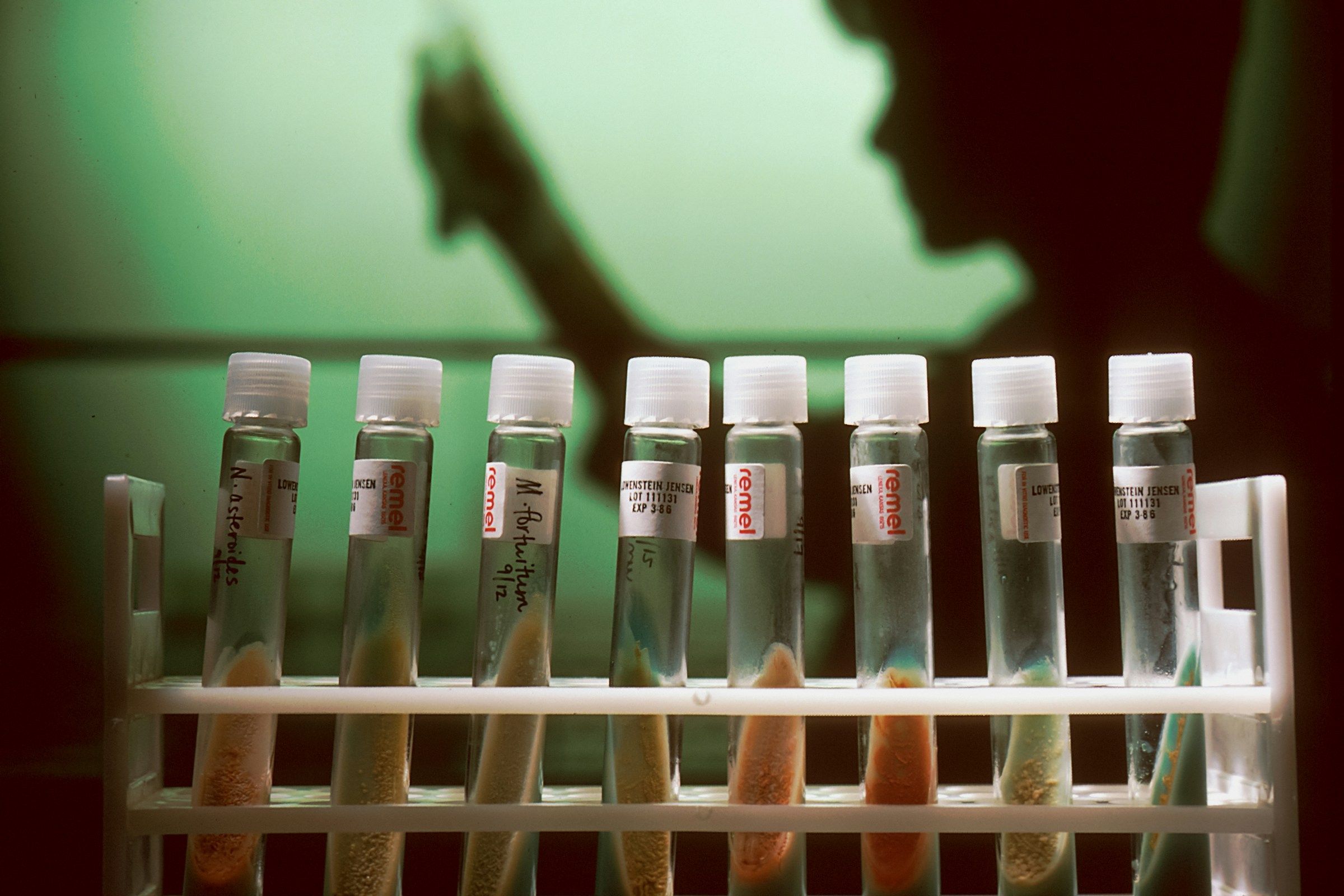 próbówki laboratorium rak