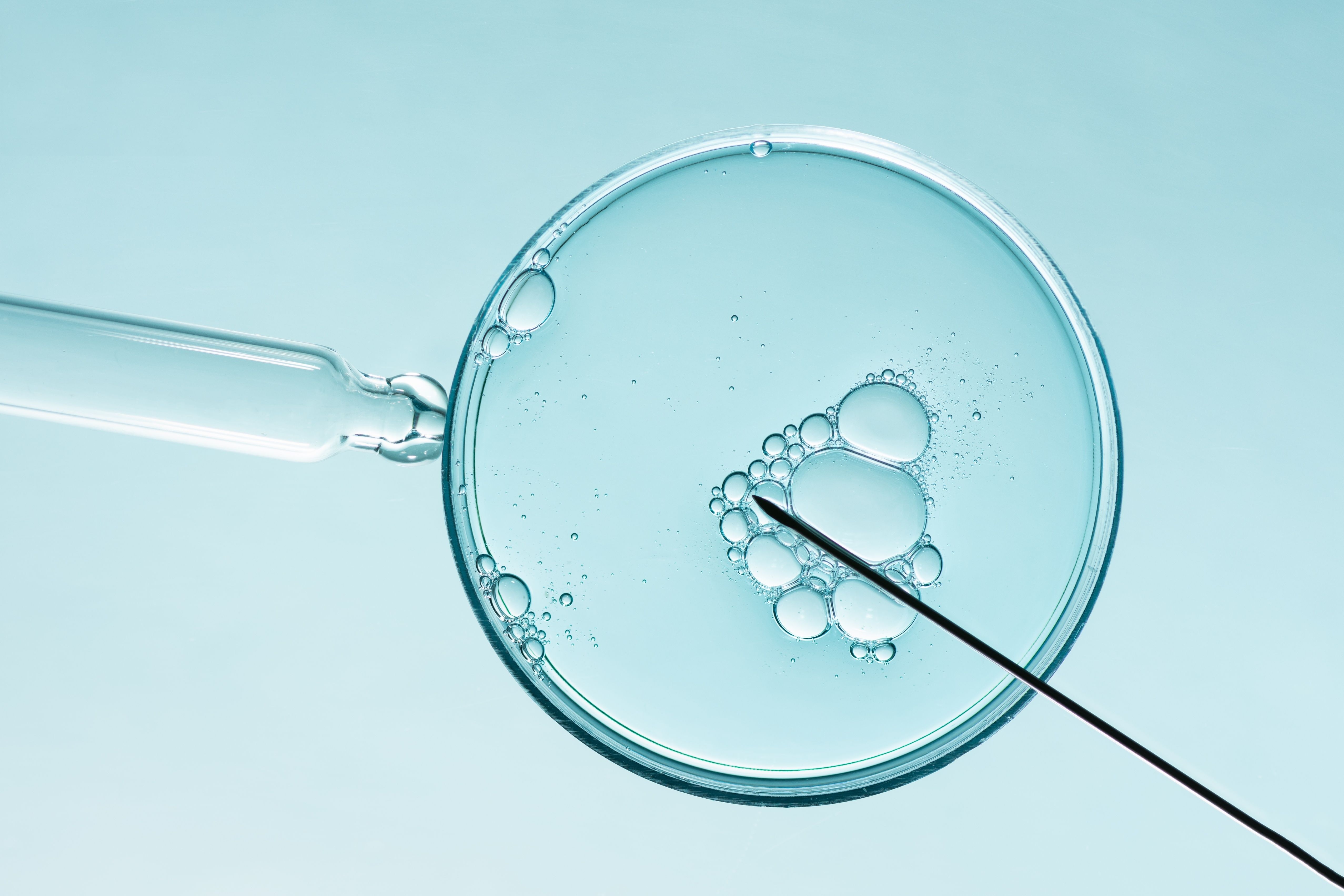 Procedura in vitro.