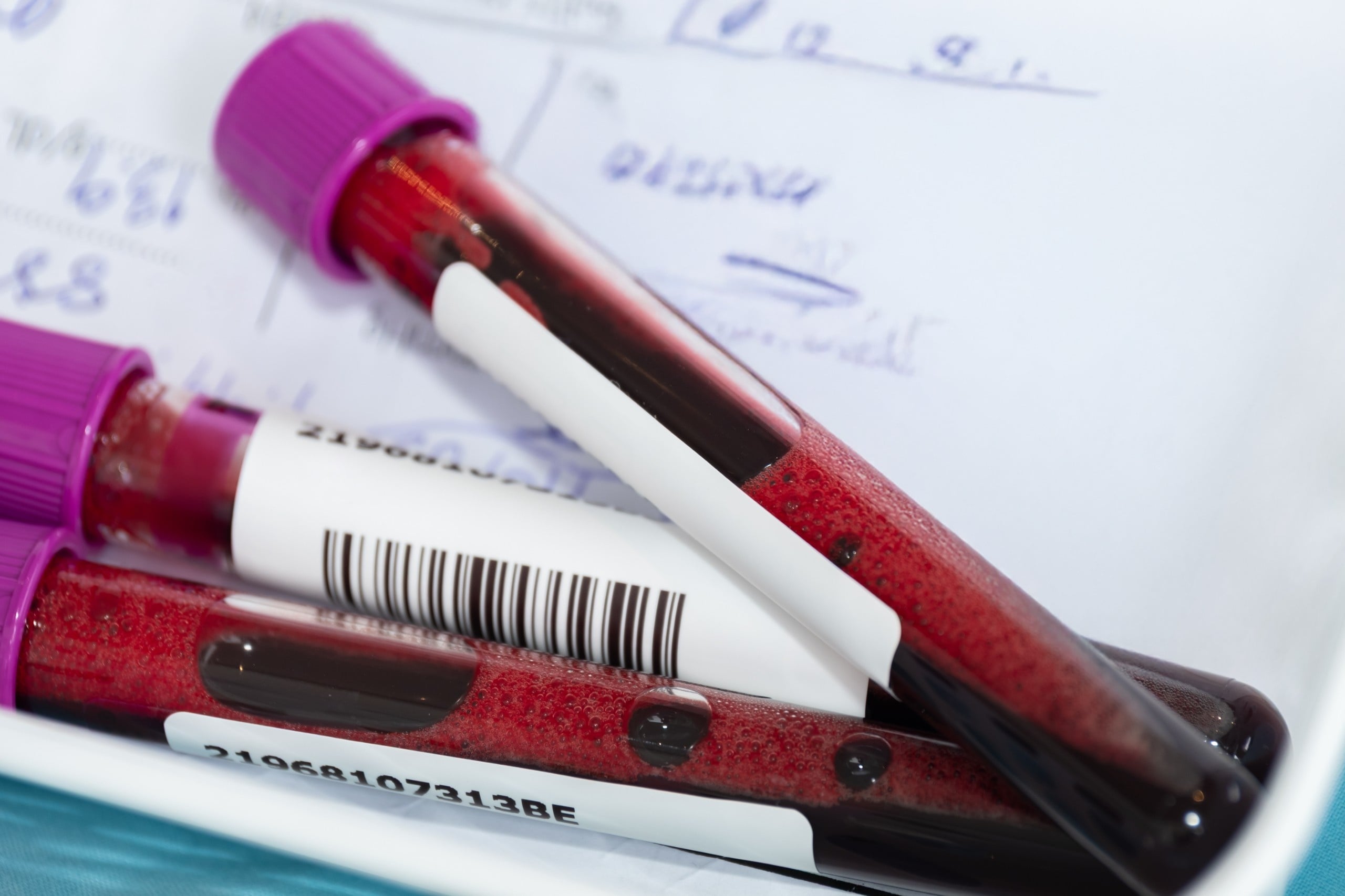Close,Up,Of,Blood,Samples,In,Test,Tubes,With,Barcode