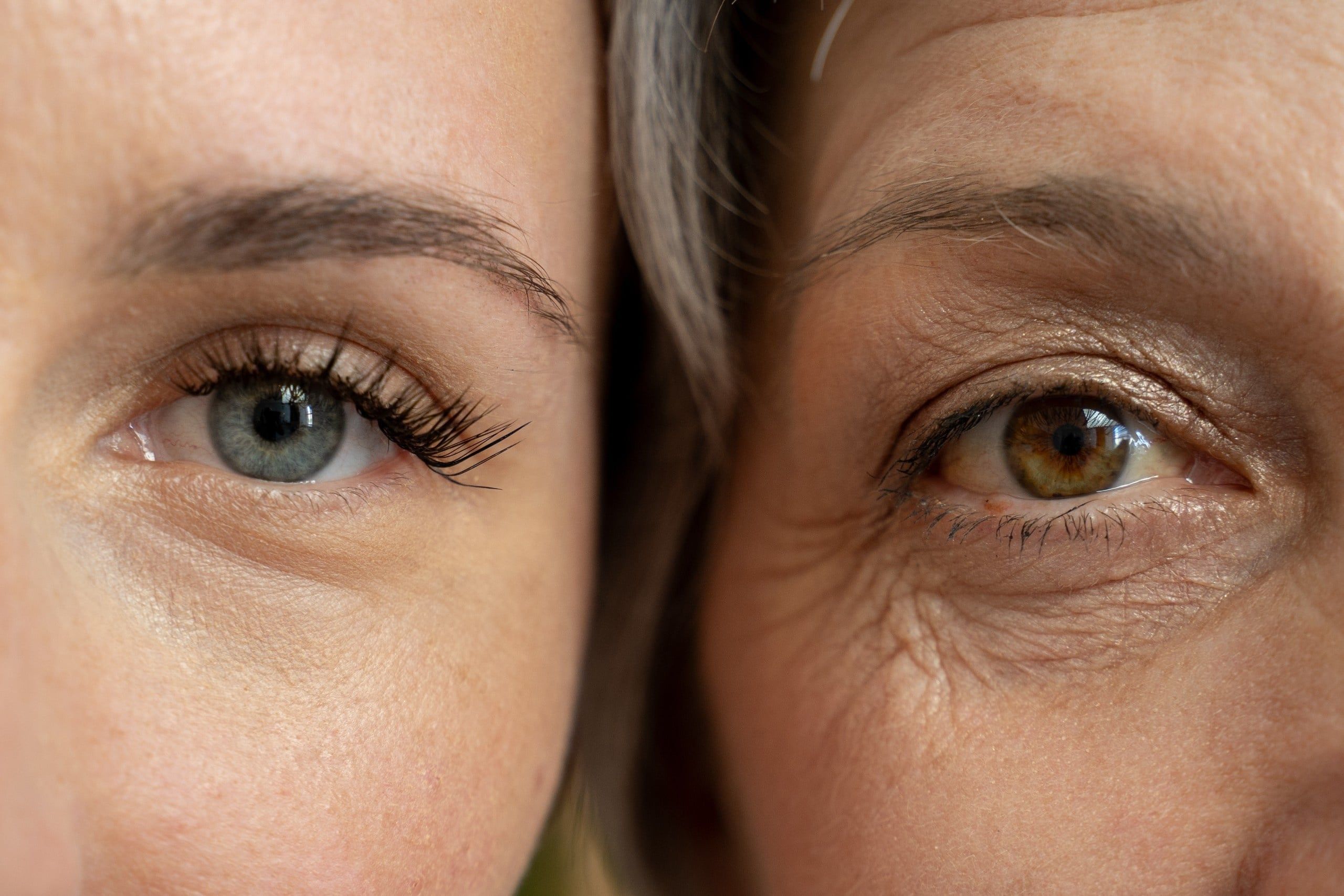 A,Close-up,Comparison,Of,The,Eyes,Of,A,Young,Woman