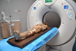 Ta mumia pamięta czasy Chrystusa. Polscy lekarze pokazali, co ma w środku