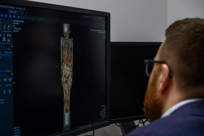 Wojewódzkiego Szpitala Specjalistycznego im. Stefana Kardynała Wyszyńskiego w Lublinie.