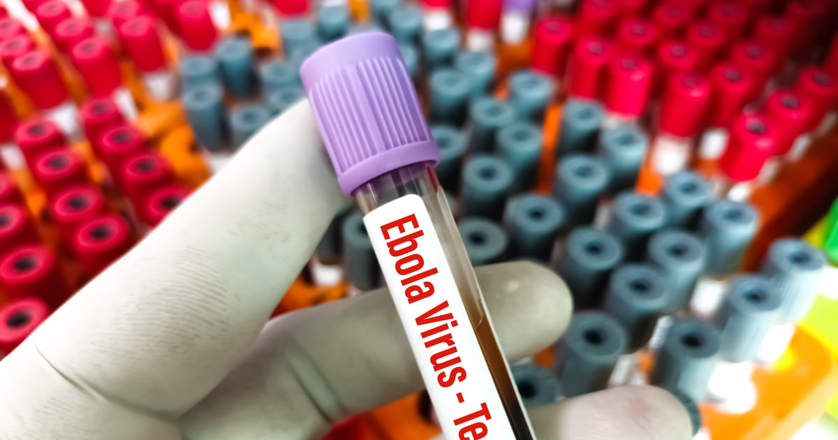 Kolejne ognisko Eboli w Afryce. Zwołano pilne spotkanie