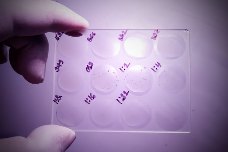 Patogen z prehistorii. W Kolumbii odkryto pradawną odmianę kiły