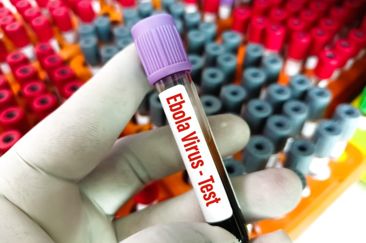 ebola